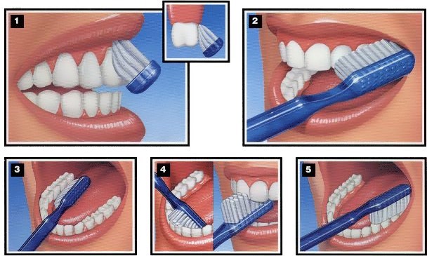Comment bien brosser ses dents : astuces efficaces